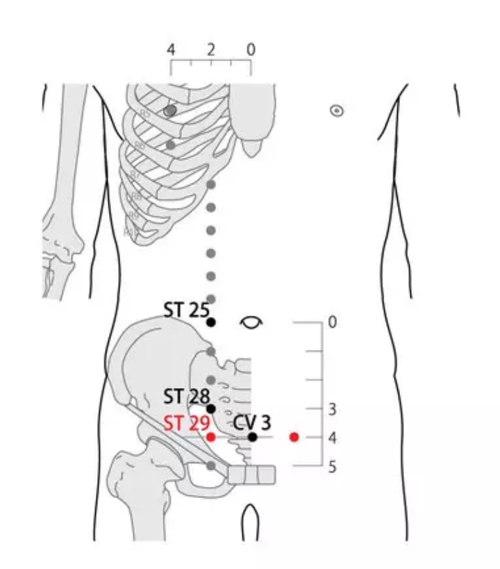 SaroEpic Acupuncture Top 5 acu points and 5 things that can help you