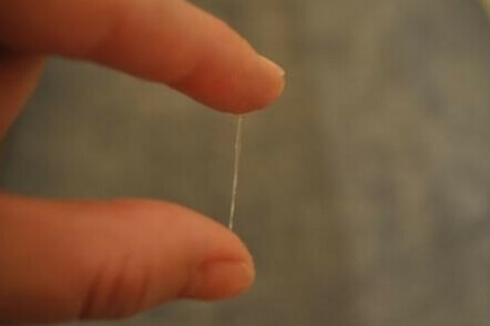 أعراض الحمل  أعراض الحمل