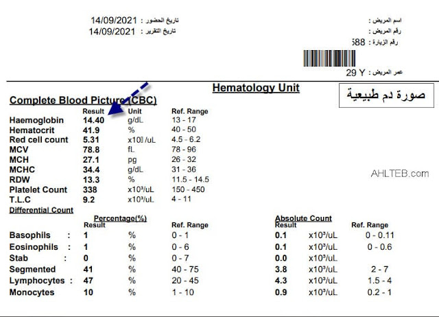 تحليل CBC صورة الدم الطبيعية لمريض مصري