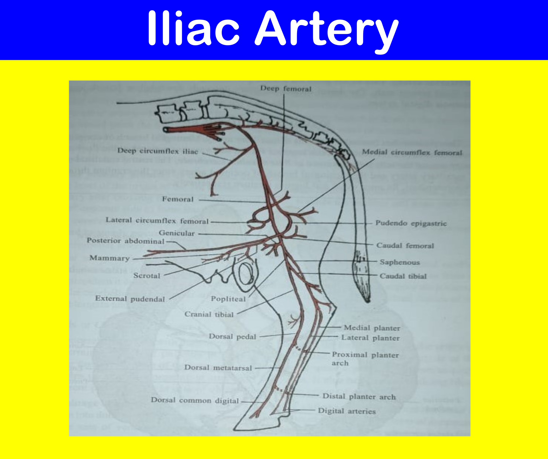 Mastering Anatomy: Iliac Artery Subdivision Explained Simply - q5tr9fl