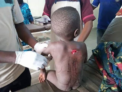Photos: Many feared dead, scores injured as suspected Fulani herdsmen attack Benue community