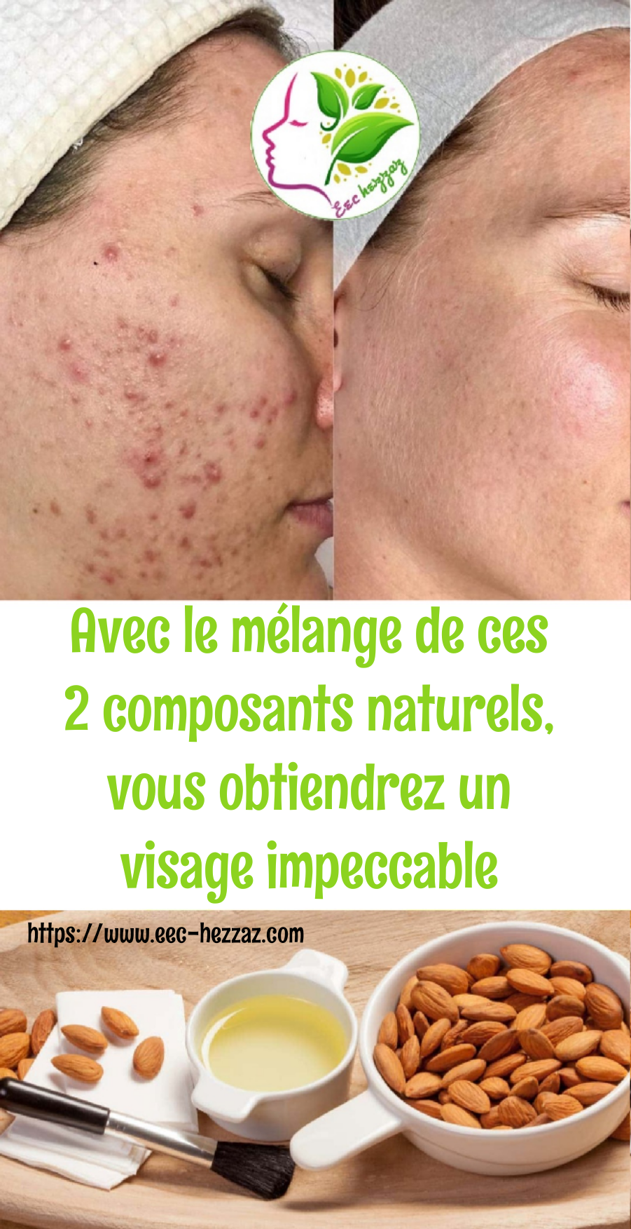 Avec le mélange de ces 2 composants naturels, vous obtiendrez un visage impeccable