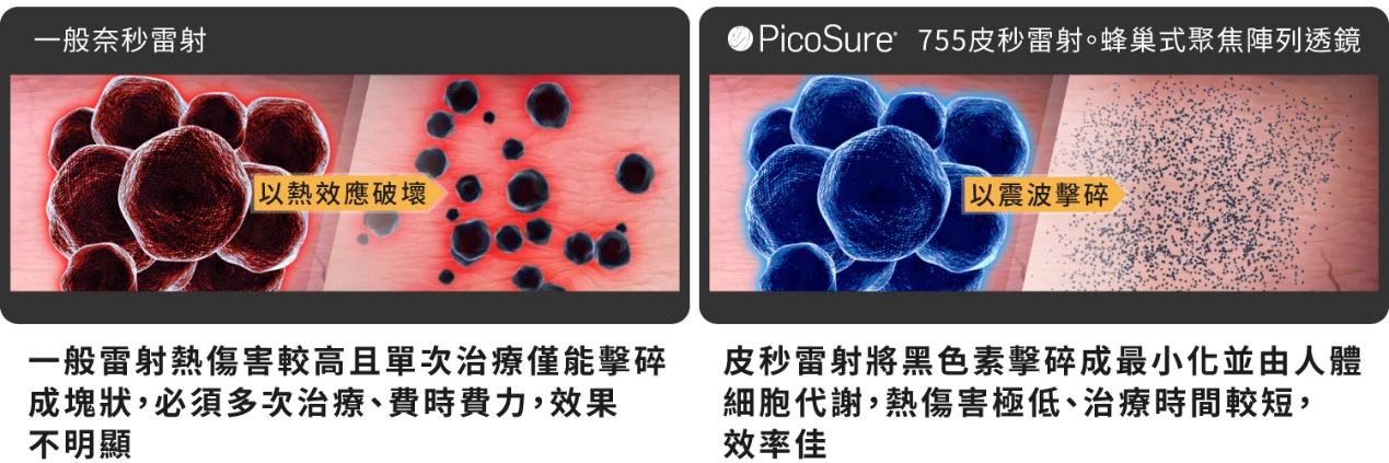 皮秒雷射反黑恢復期PicoSure755皮秒雷射雷射比較蜂巢式聚焦陣列透鏡蜂巢透鏡皮秒雷射蜂巢皮秒雷射雀斑曬斑除斑痘疤毛孔細紋問答qa755蜂巢皮秒雷射二代皮秒超皮秒新一代皮秒雷射新竹皮秒雷射推薦醫師皮膚科醫師痘疤凹疤飛梭雷射皮秒雷射價格價錢術後保養副作用除斑凹洞淨膚雷射林亮辰皮膚專科診所林亮辰醫師新竹皮膚科皮秒雷射推薦