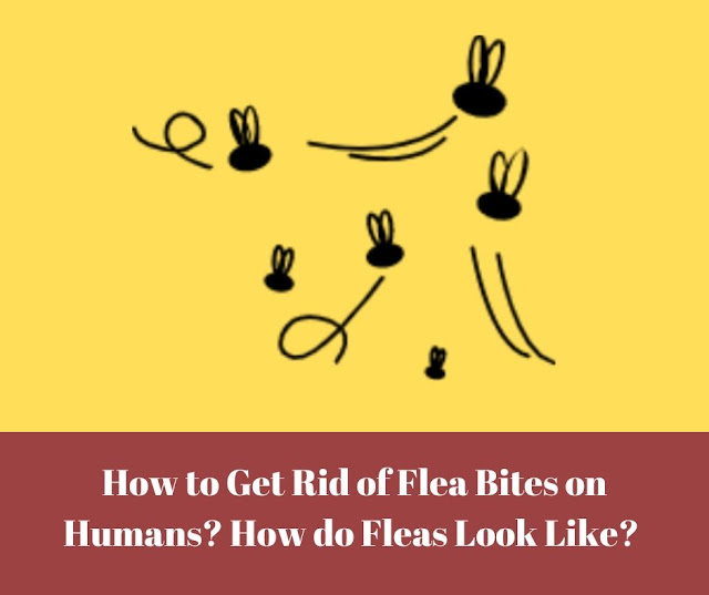 How to get rid of flea bites on humans? How do fleas look like? How to get rid of flea bites on humans? How do fleas look like?