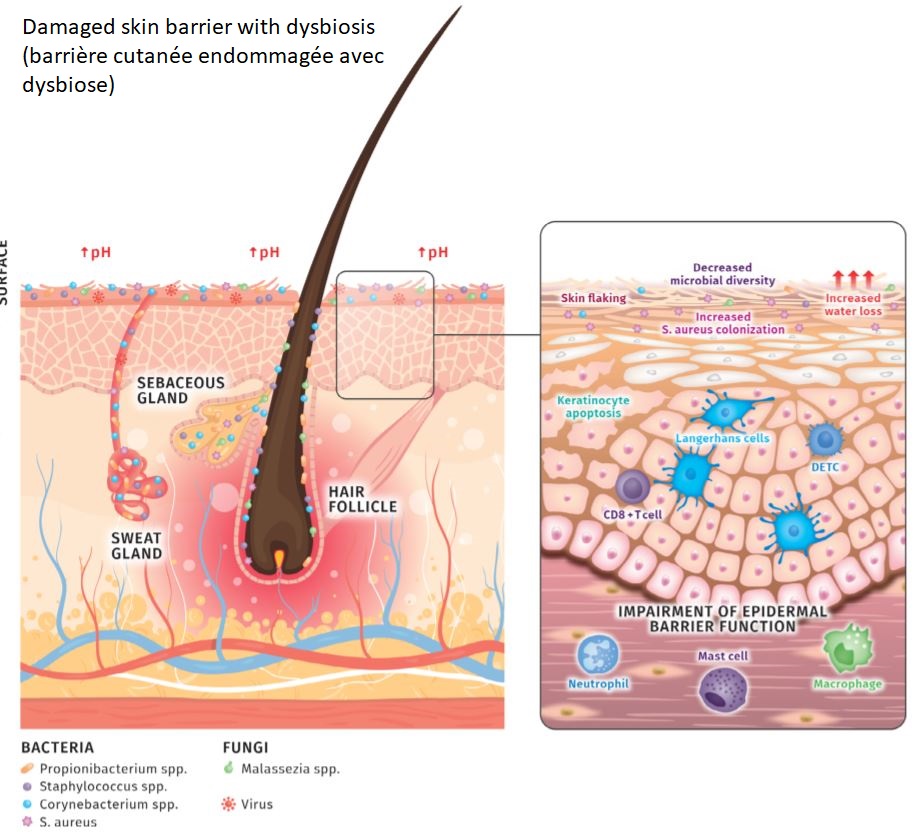 dysbiosis ncbi