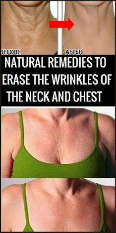 Natural Remedies To Erase The Wrinkles Of The Neck And Chest