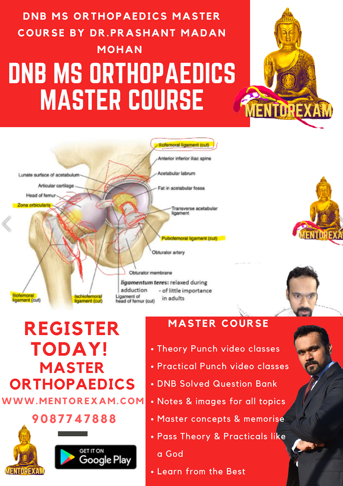 How to pass DNB MS Orthopaedics theory and practical exams Dr