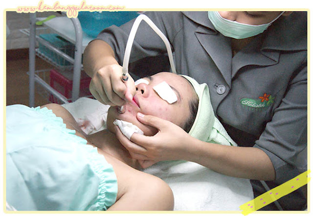 Ozone Jet Peel Facial