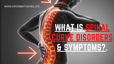 SPINAL CURVE DISORDERS