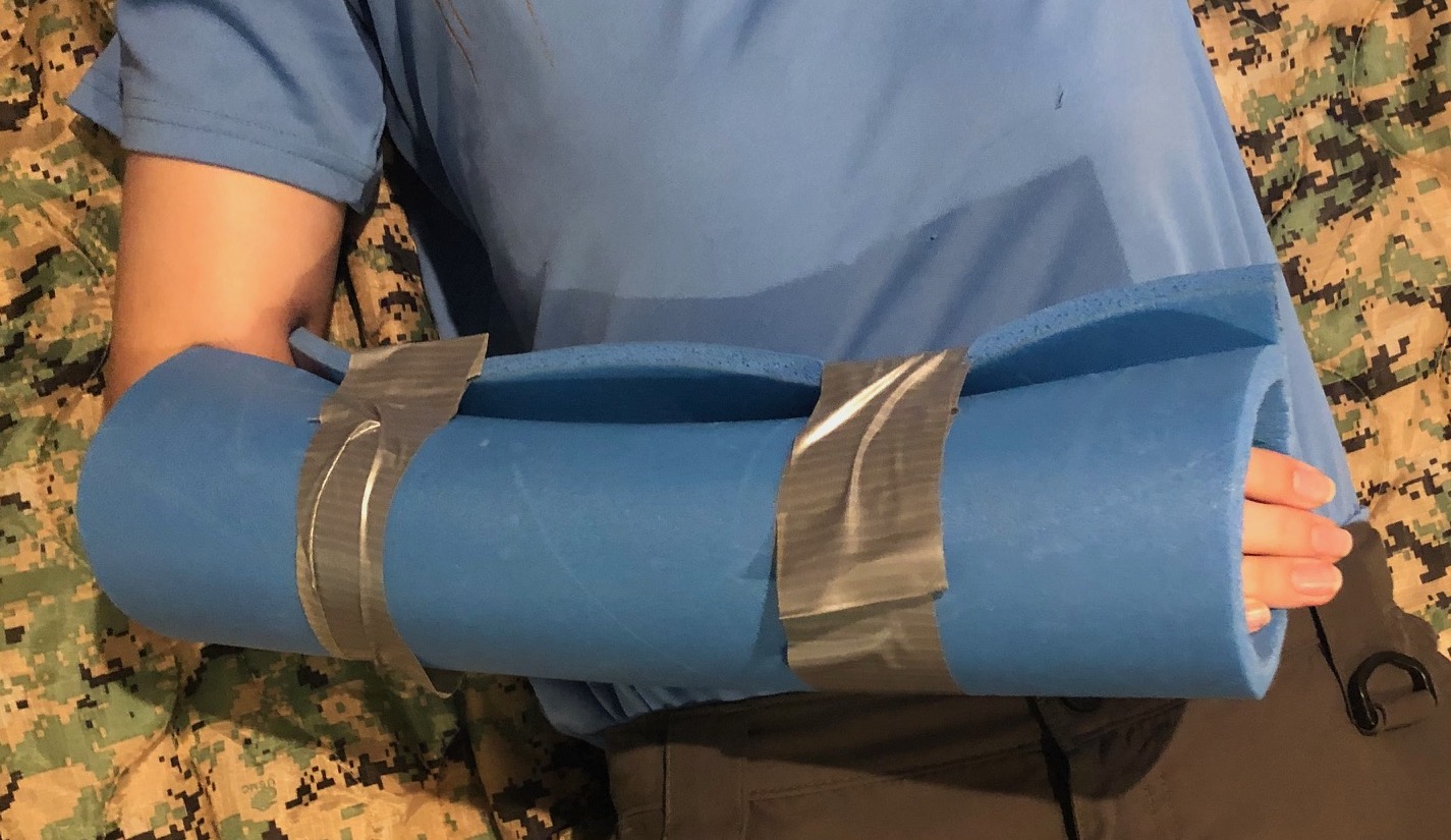 Improvised Splints
