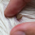How to remove a tick without a forceps?