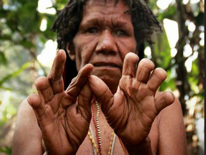 Tradisi Potong Jari Dalam Masyarakat Papua Hindu Alukta
