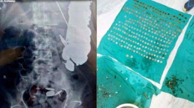 Akibat Depresi Akut, Pria Ini Mempunyai Kebiasaan Makan Yang Tidak Biasa Akibat Depresi Akut, Pria Ini Mempunyai Kebiasaan Makan Yang Tidak Biasa