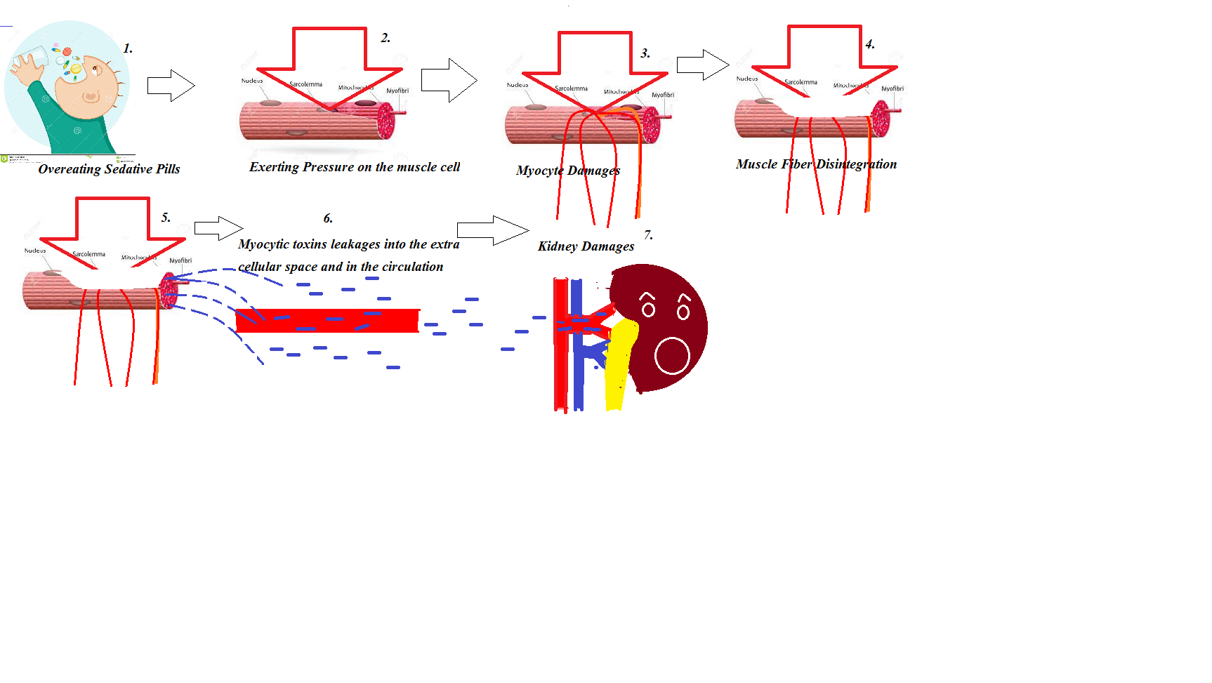 MAS PHARMACY REVIEWHEALTH TIMES DO SLEEPING PILLS DAMAGE KIDNEYS?