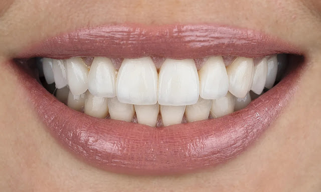 I dentisti rivelano le cose che i denti ti dicono sulla tua salute