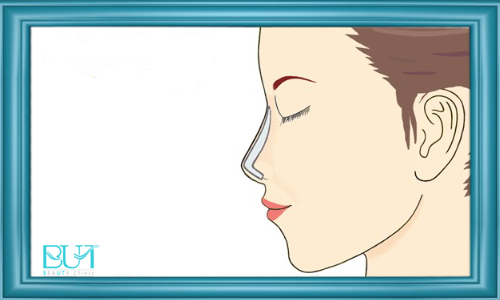 مراقبت های بعد از جراحی بینی یا رینوپلاستی | بیوتی کلینیک مراقبت های بعد از جراحی بینی یا رینوپلاستی | بیوتی کلینیک