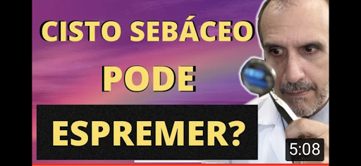 CISTO SEBÁCEO: PODE ESPREMER?