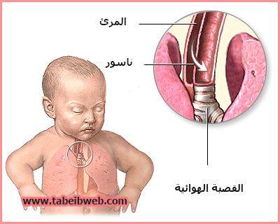 Пищевод у новорожденного. Трахея у новорожденного ребенка.