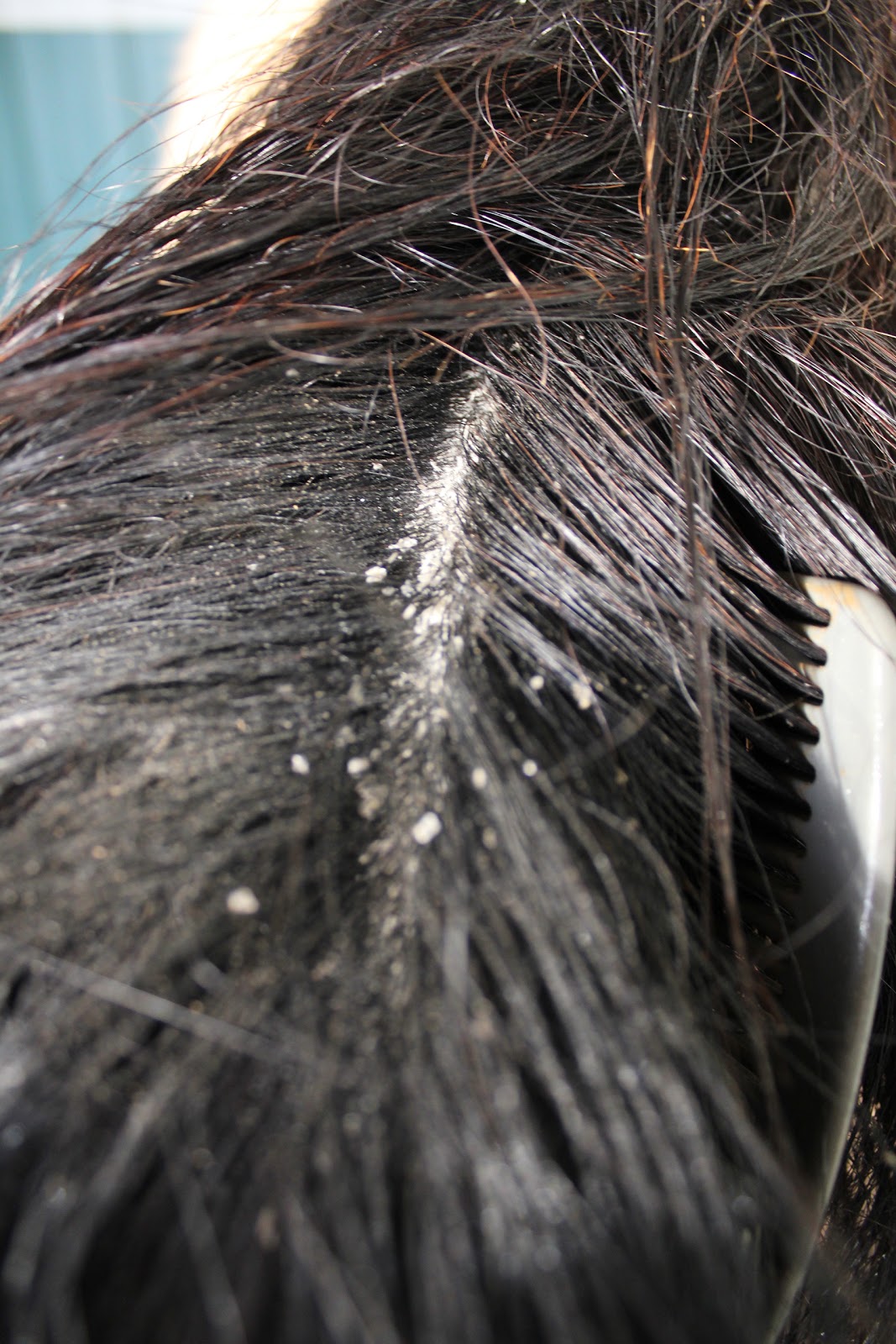 Just Horses Dander White Vinegar?