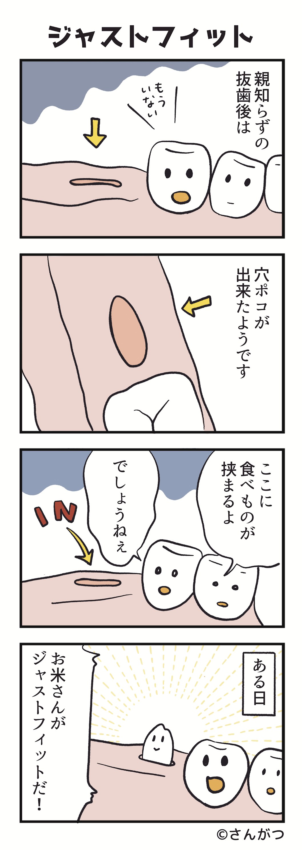 歯科矯正の漫画１０「親知らずの抜歯・・・ジャストフィット編」