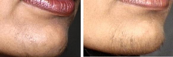 why do women grow facial hair Amateur pussy loving