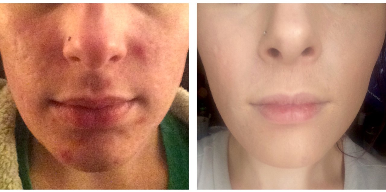 Makeup Artist's Choice Before/After Pics and Testimonials