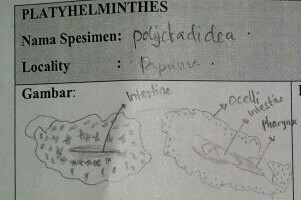 Emberi szem – Wikipédia Ciliáris férgek, Laporan praktikum platyhelminthes planaria