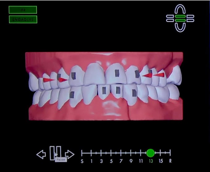 ORTHODONTICS: Clear Correct - Steven T. Cutbirth, DDS