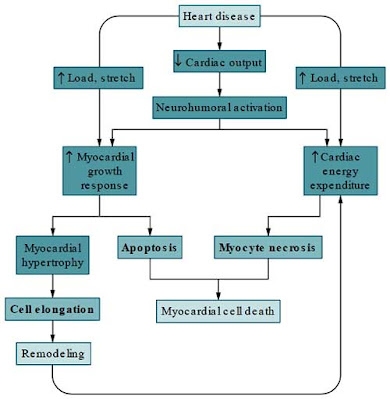 systolic heart failure