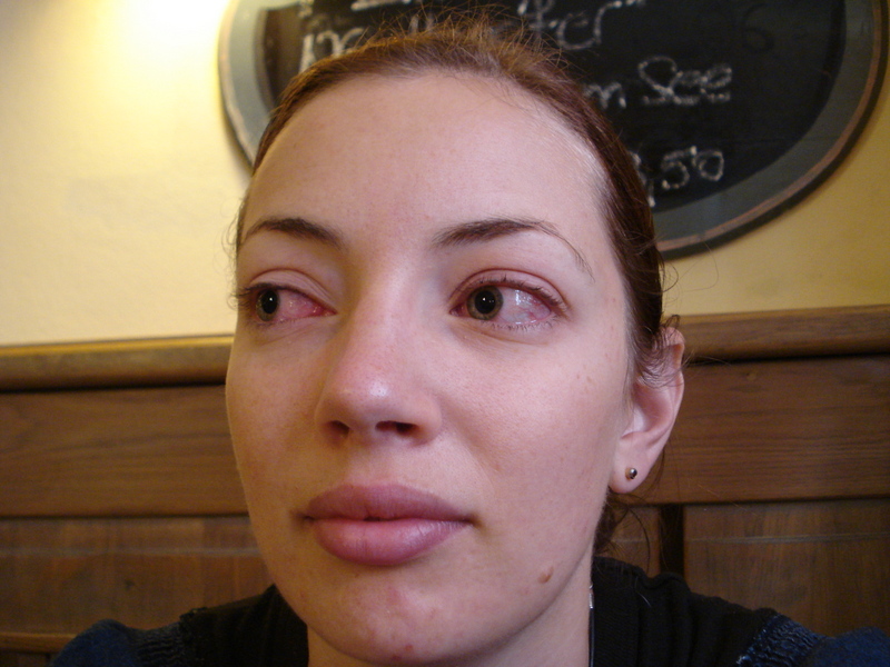 Always Tired Eyes Always Tired And Heavy