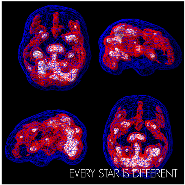 Amen Clinic Brain Scans while Resting Part 2