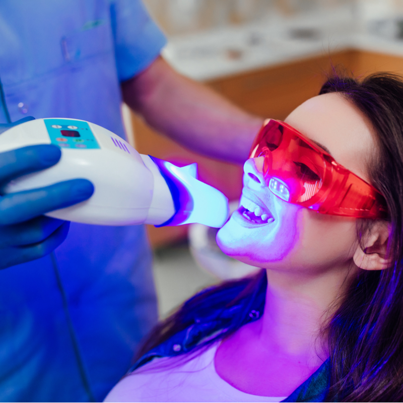 Professional Teeth Whitening in HoustonTX