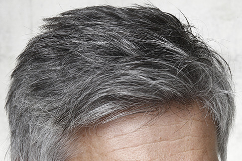 Home Remedies To Reduce White Hair