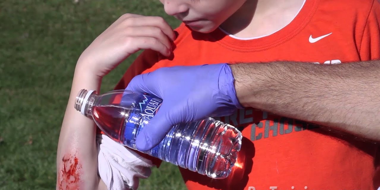 Haemorrhage or bleeding , type of haemorrhage or control of bleeding