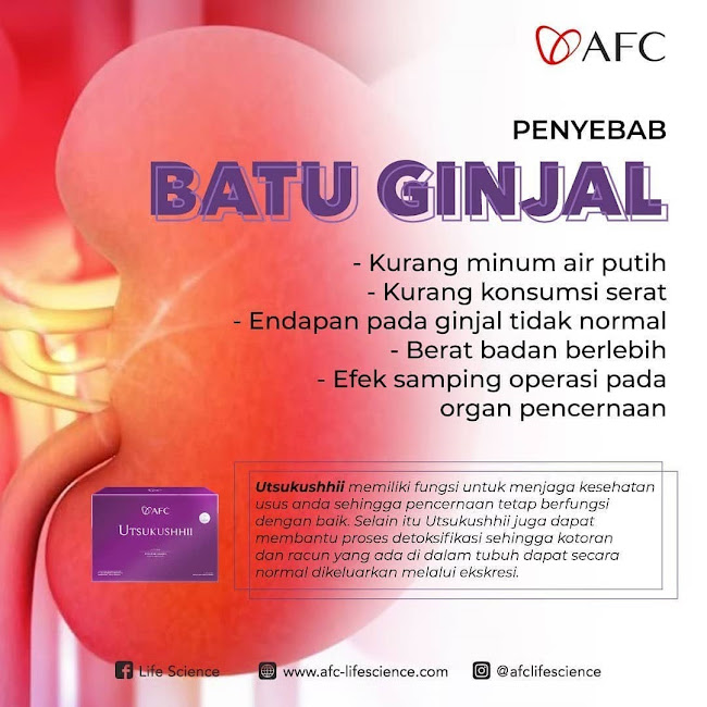 SOP Subarashi Jepang: Solusi Obat Stem Cell yang Murah dan Halal<br/> SOP Subarashi Jepang: Solusi Obat Stem Cell yang Murah dan Halal<br/>.