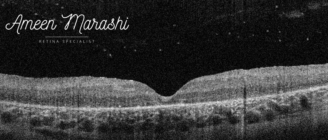 ConeRod Dystrophy complicated with cystoid macular edema