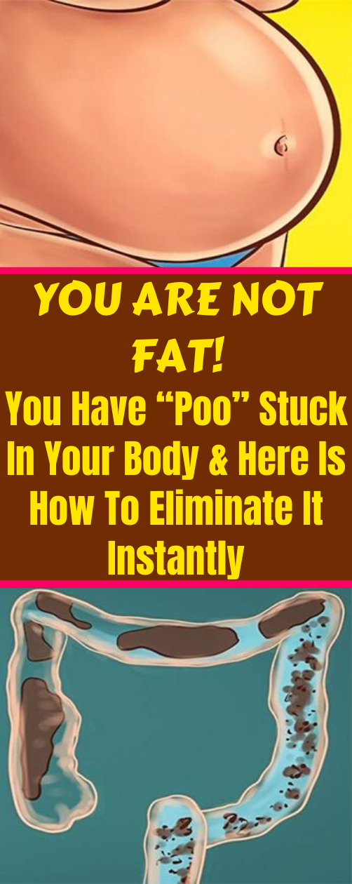 You Are Not Fat!! You Have “Poo” Stuck In Your Body & Here Is How To Eliminate It Instantly