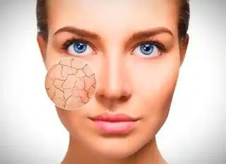 IMG_20210920_215701_8834 শুষ্ক ত্বকের সমস্যা দূর করতে সেরা ১০ টি টিপস -Top 10 Tips To Get Rid Of Dry Skin Problems