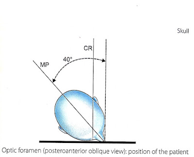 Optic foramen ( six views of skull)