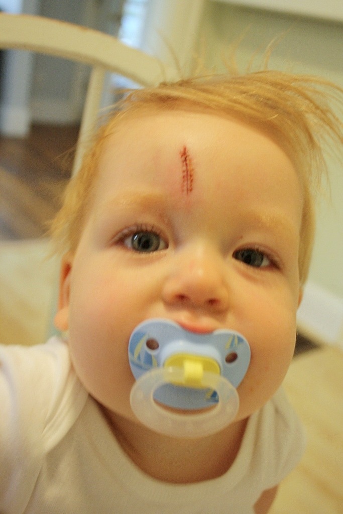 A Barefoot Day Scarface