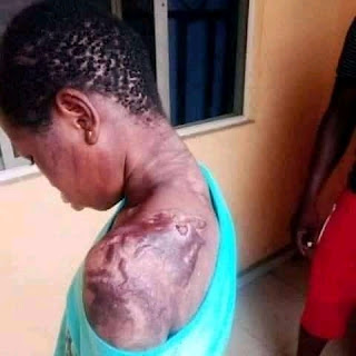 Photos: Heartless woman poured hot water mixed with pepper on 10 years old maid. (3)