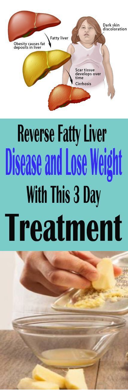 Reverse Fatty Liver Disease And Lose Weight With This 3 Day Treatment