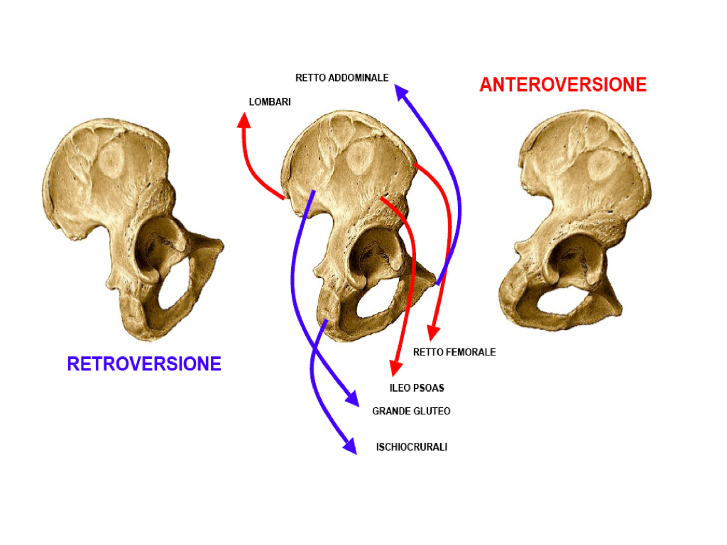 Retroversione del bacino YouTube Retroversione del bacino YouTube