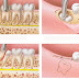 Cách xử lý sưng nướu răng trong cùng