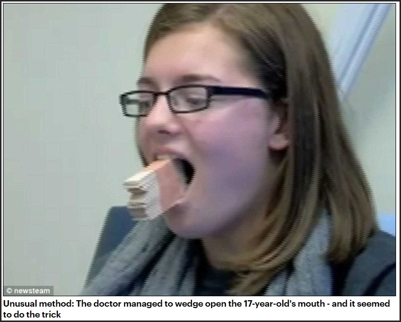 Student Dislocates Jaw While Yawning So Hard During Lecture