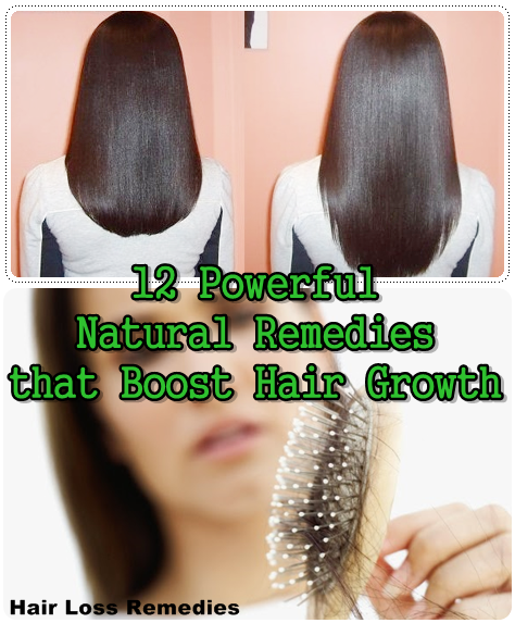12 Powerful Natural Remedies that Boost Hair Growth and Prevent Hair Loss
