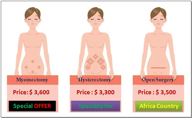Fibroid Surgery Packages in India