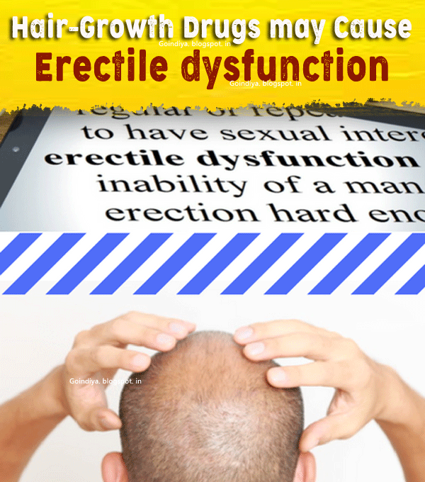 HairGrowth Drugs may Cause Erectile dysfunction that lasts for years