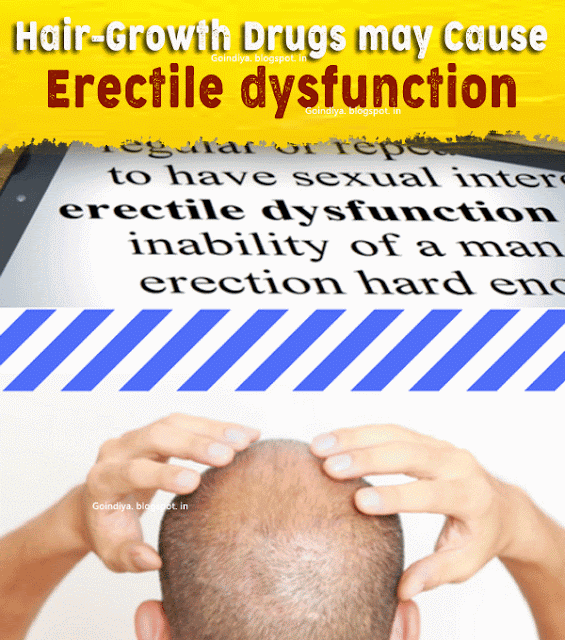 HairGrowth Drugs may Cause Erectile dysfunction that lasts for years