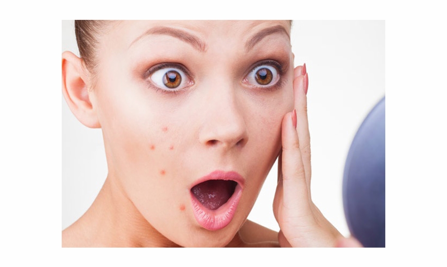 Pimple Pimple Go Away, Dont come again another day.